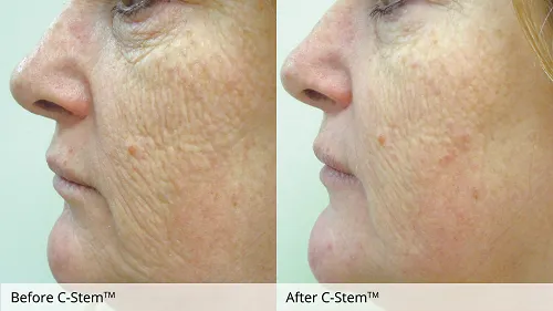 C-Stem® 30ML Tester