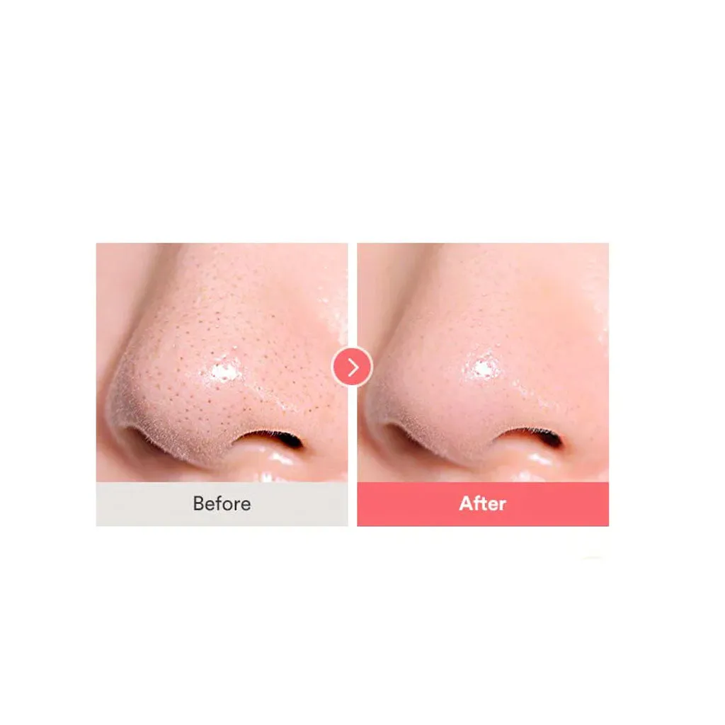 Calamine Pore Control Cleansing Oil